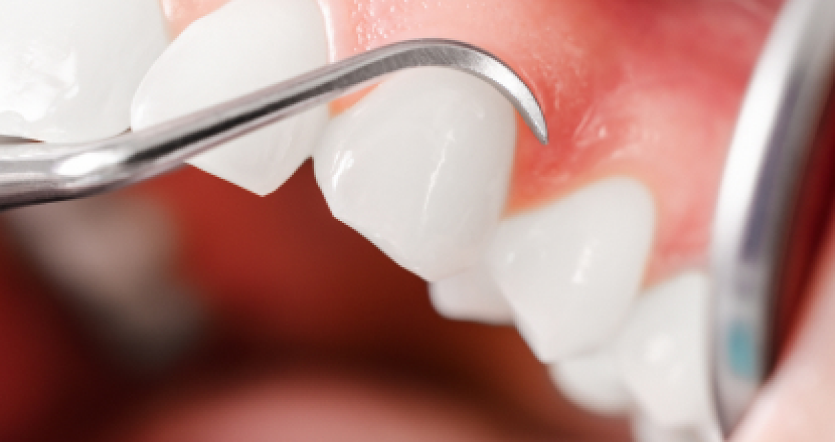 Traitement des poches