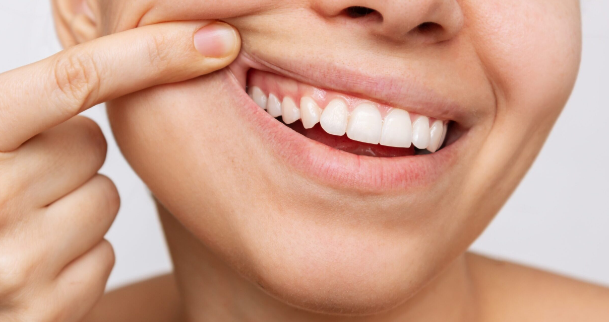 Parodontologie non chirurgicale